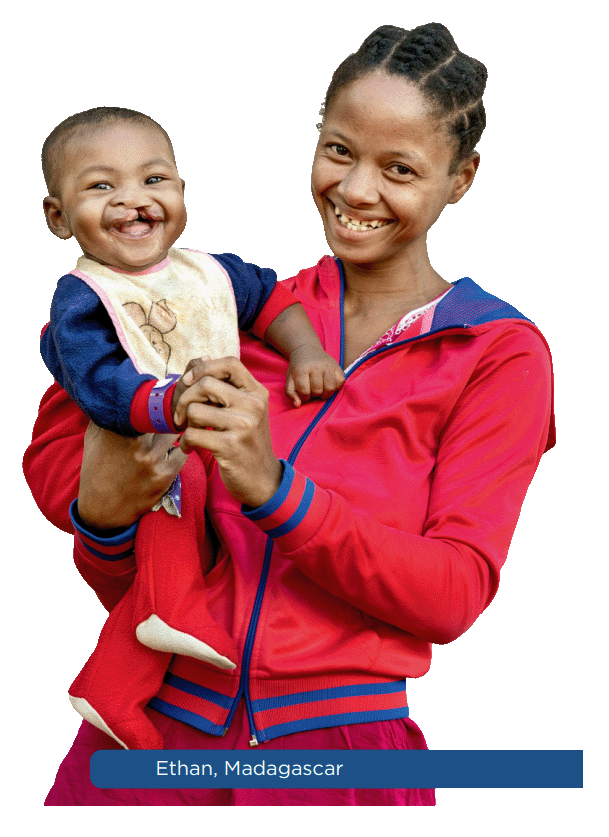 Une m&egrave;re et son enfant soutenus par Operation Smile